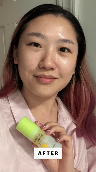 Han after applying the KraveBeauty 24 Carrot Retinal